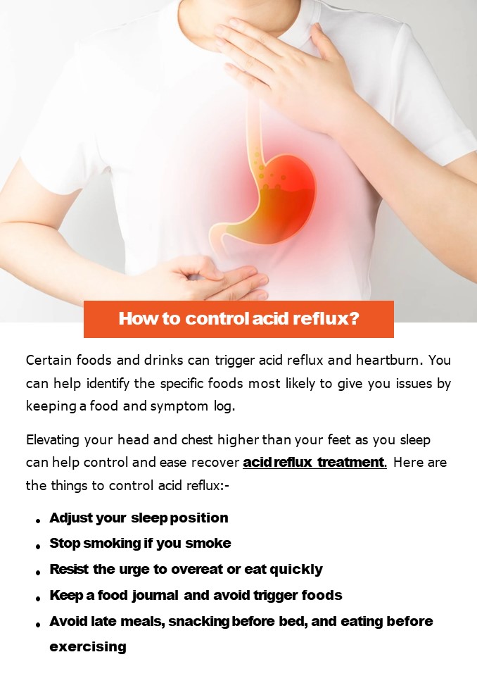 How to control acid reflux?