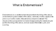 Endometriosis Treatment