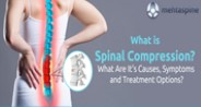 Spinal Compression Causes, Symptoms, and Treatment Options?
