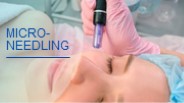 Microneedling