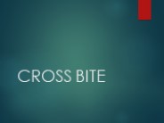 Cross bite