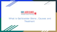 What is Gallbladder stone , Causes , Treatment