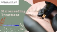 Microneedling Treatment