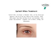 Eyelash Mites Treatment