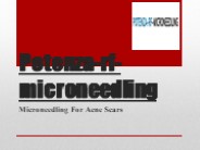Microneedling Before After