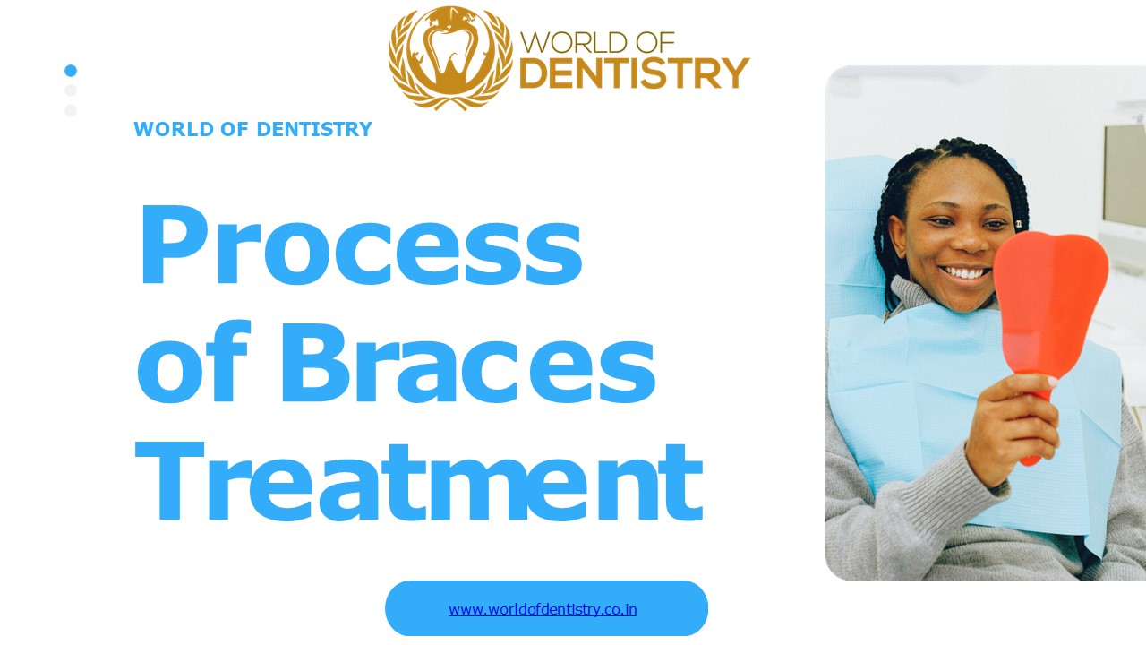 Process of braces Treatment | World of Dentistry