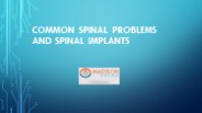 Common Spinal Problems And Spinal Implants
