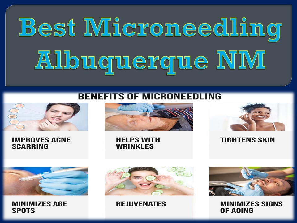 Best Microneedling Albuquerque NM