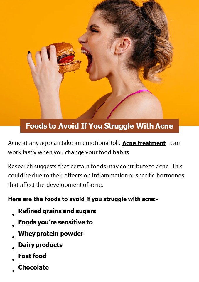 Foods to Avoid If You Struggle With Acne