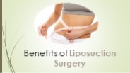 Benefits of Liposuction Surgery