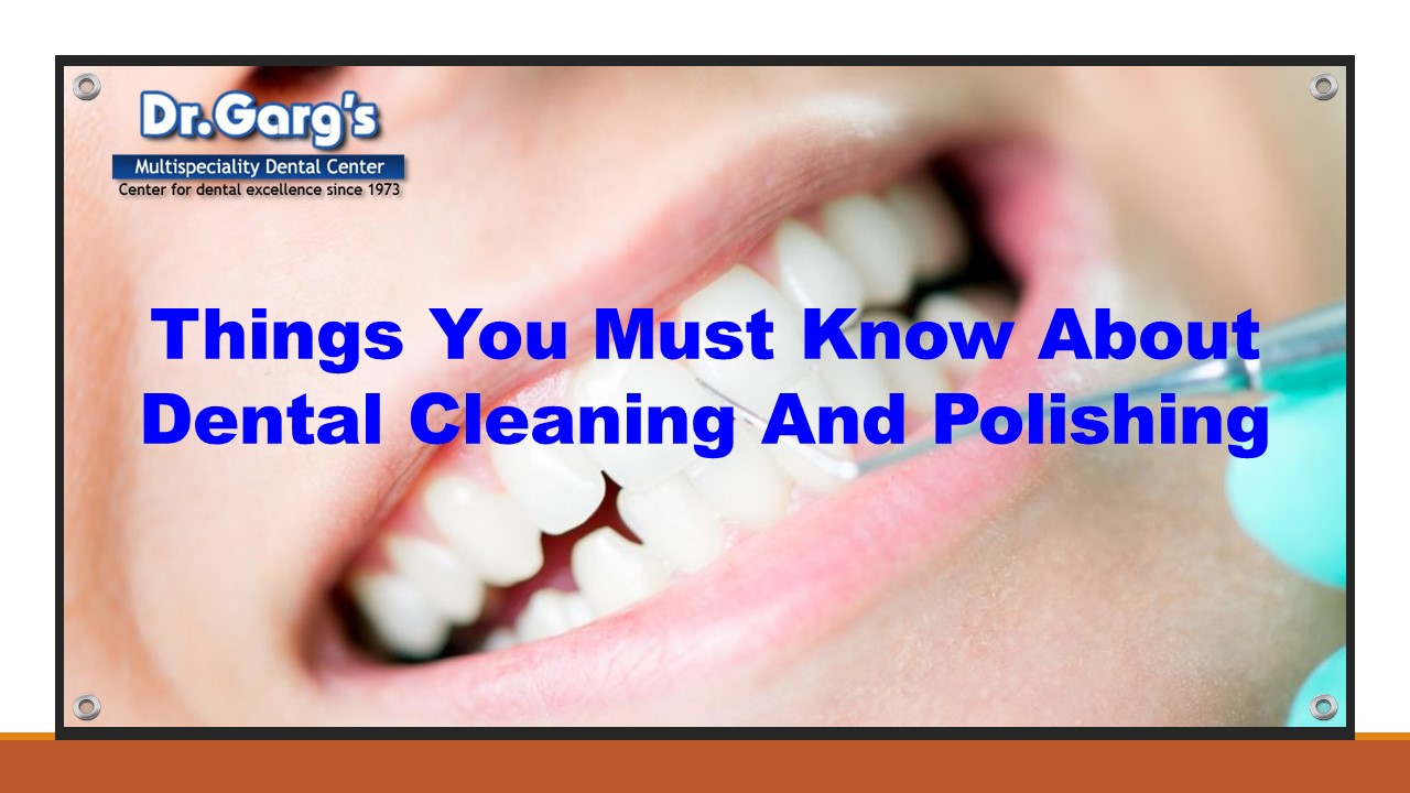 PPT Things You Must Know About Dental Cleaning And Polishing