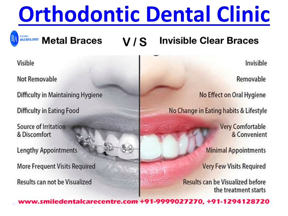 PPT Get Back Your Smile At Best Dental Clinic in Faridabad PowerPoint