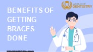 Benefits of getting braces done