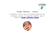 Demodex Folliculorum Treatment
