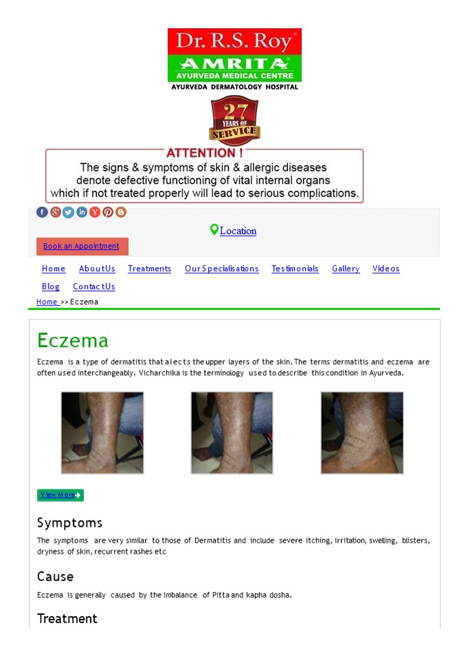 PPT Best Ayurvedic Dermatologist Treating Eczema Dr.RS.ROY Amrita