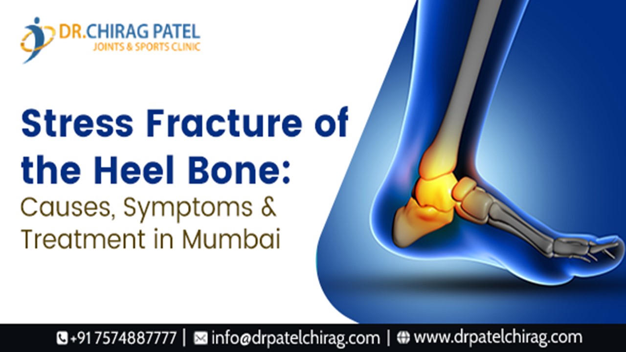 PPT Stress Fracture of the Heel Bone Symptoms & Treatment