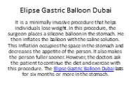 Gastric Balloon in Dubai (7)