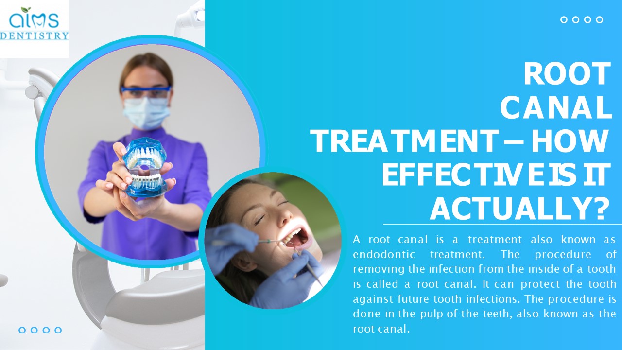 PPT Best Root Canal Treatment Mississauga PowerPoint presentation