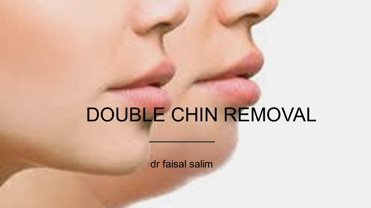 double chin reduction