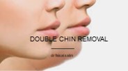 double chin reduction