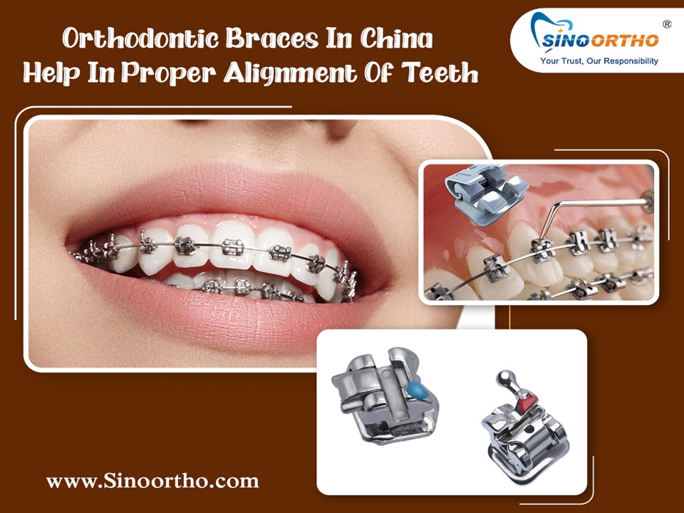 PPT Orthodontic Braces In China Help In Proper Alignment Of Teeth