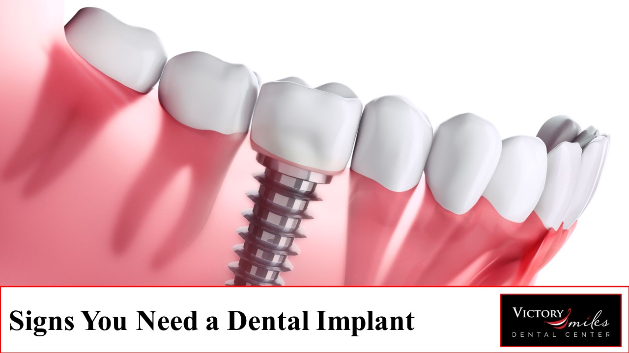 Smile with Confidence: Reasons to Consider Getting Dental Implants