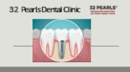 Dental Implant in India