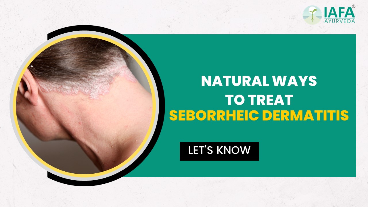 Natural treatment of seborrheic dermatitis