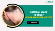 Natural treatment of seborrheic dermatitis