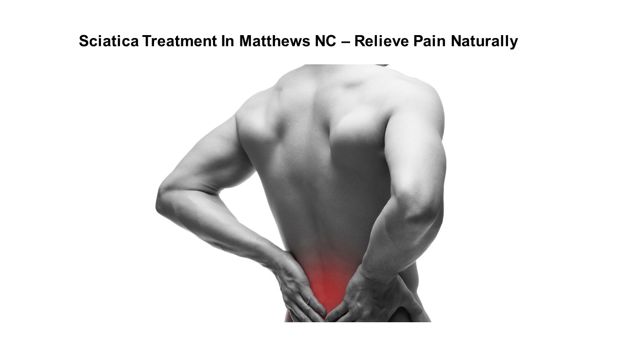 Sciatica Treatment in Matthews NC – Relieve Pain Naturally