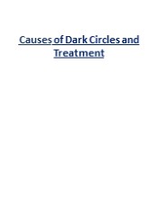 Causes of Dark Circles and Treatment