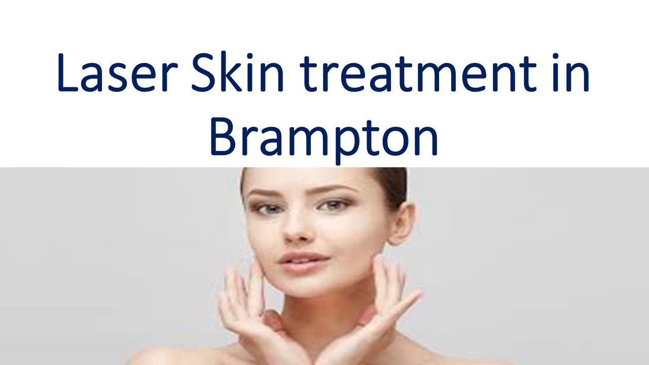 Laser Skin treatment in Brampton