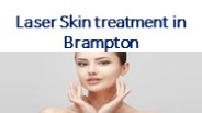 Laser Skin treatment in Brampton