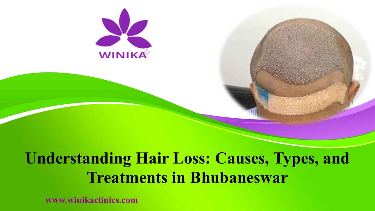 Understanding Hair Loss: Causes, Types, and Treatments in Bhubaneswar