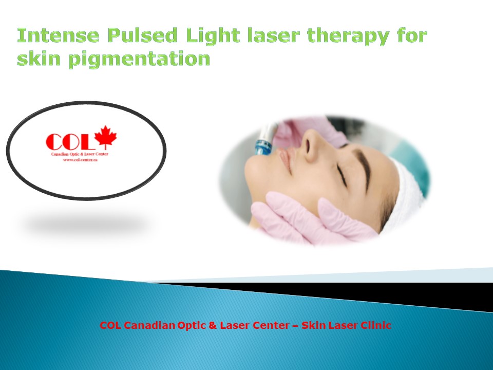 Intense Pulsed Light laser therapy for skin pigmentation