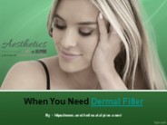 When You Need Dermal Filler