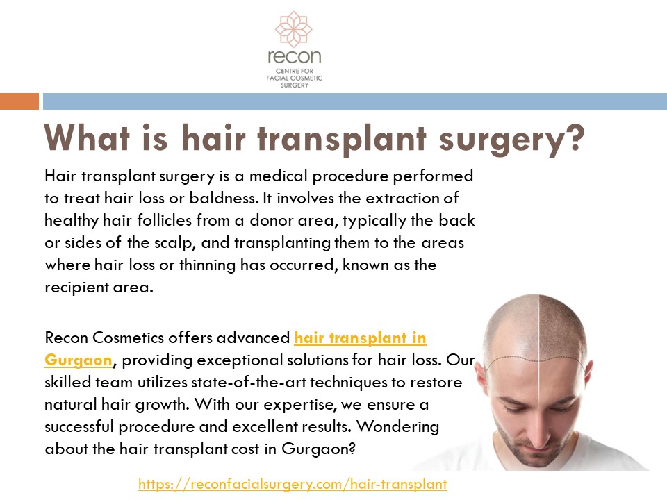 Best Hair Transplant Surgeon in Gurgaon | RECON