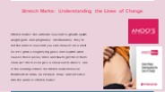 Stretch Marks_ Understanding the Lines of Change
