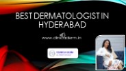 Best Dermatologist in Hyderabad