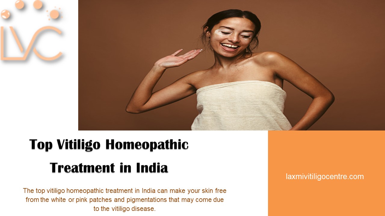 Top Vitiligo Homeopathic Treatment in India