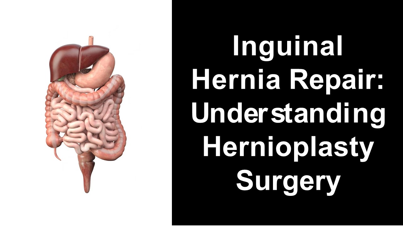 Inguinal Hernia Hernioplasty Surgery Cost In Vadodara