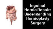 Inguinal Hernia Hernioplasty Surgery Cost In Vadodara