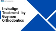 Invisalign Treatment