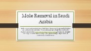 Mole Removal in Saudi Arabia