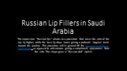 Russian Lip Fillers in Saudi Arabia