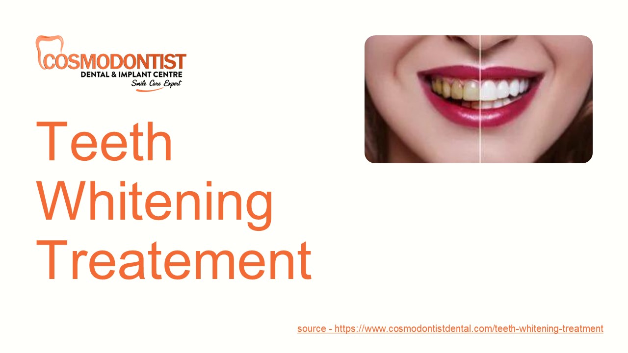 Teeth Whitening Treatment
