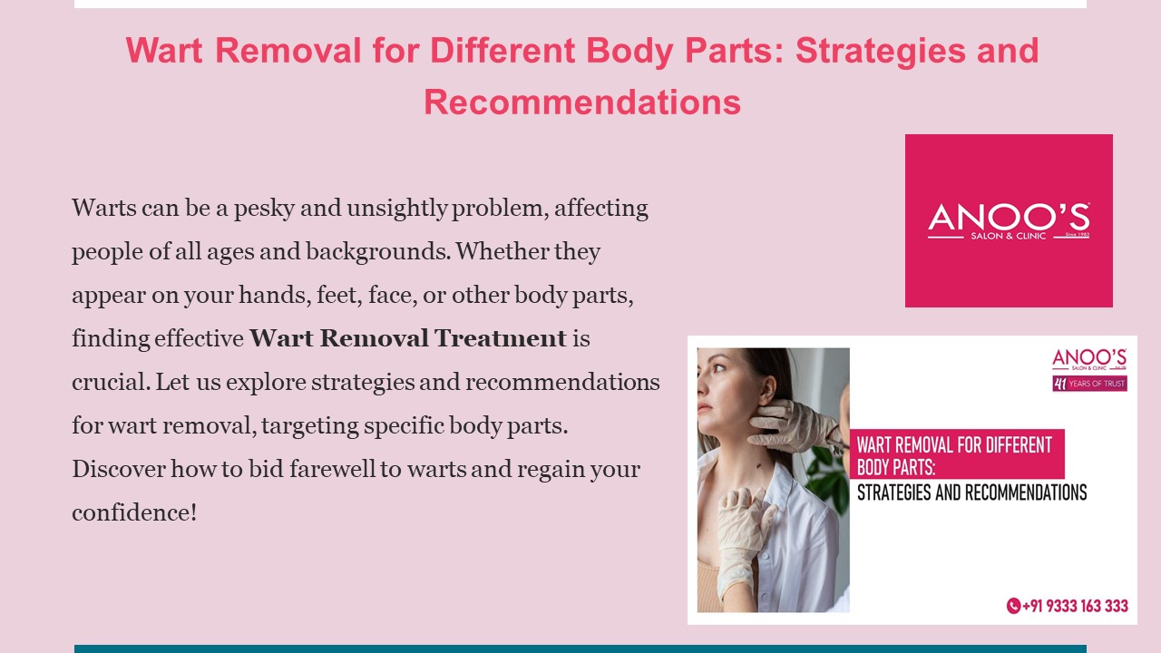 Wart Removal for Different Body Parts: Strategies and Recommendations