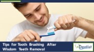How to Brush Teeth After Wisdom Teeth Extraction