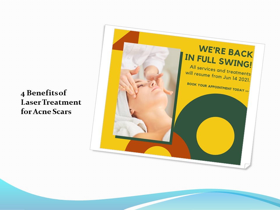 4 Benefits of Laser Treatment for Acne Scars