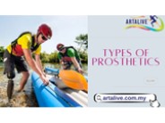 Types of prosthetics: Artalive